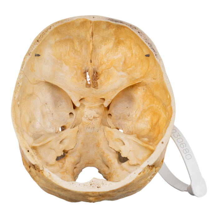 Real Human Skull - Partial