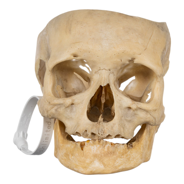 Real Human Skull - Partial