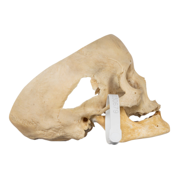 Real Human Skull - Partial