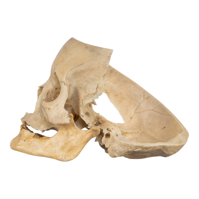 Real Human Skull - Partial