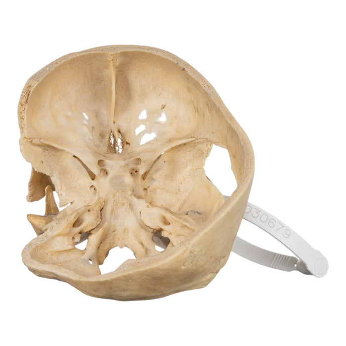 Real Human Skull - Partial
