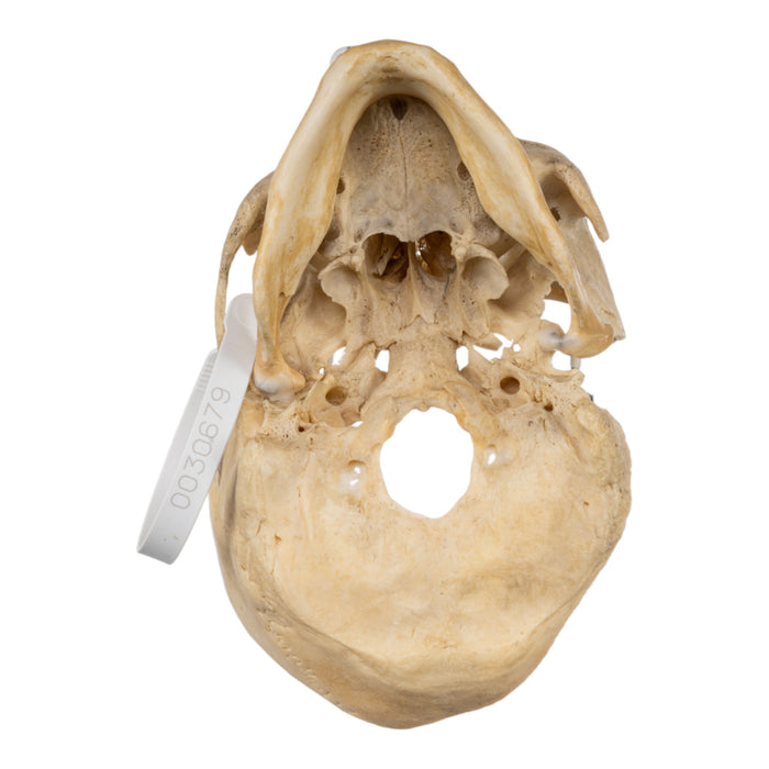 Real Human Skull - Partial