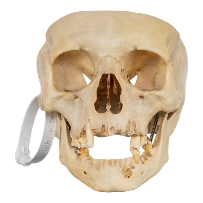 Real Human Skull - Partial