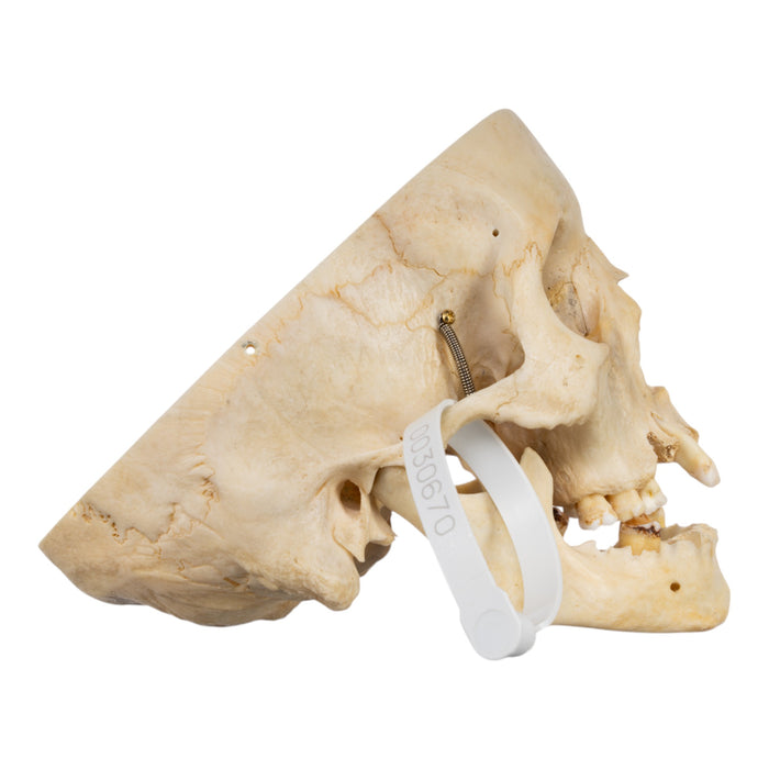 Real Human Skull - Partial