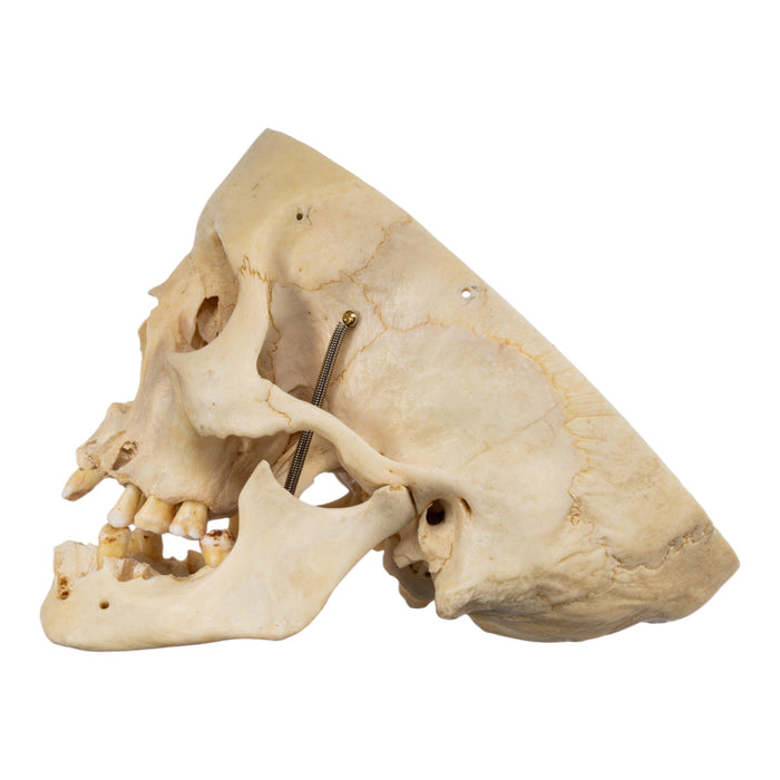 Real Human Skull - Partial