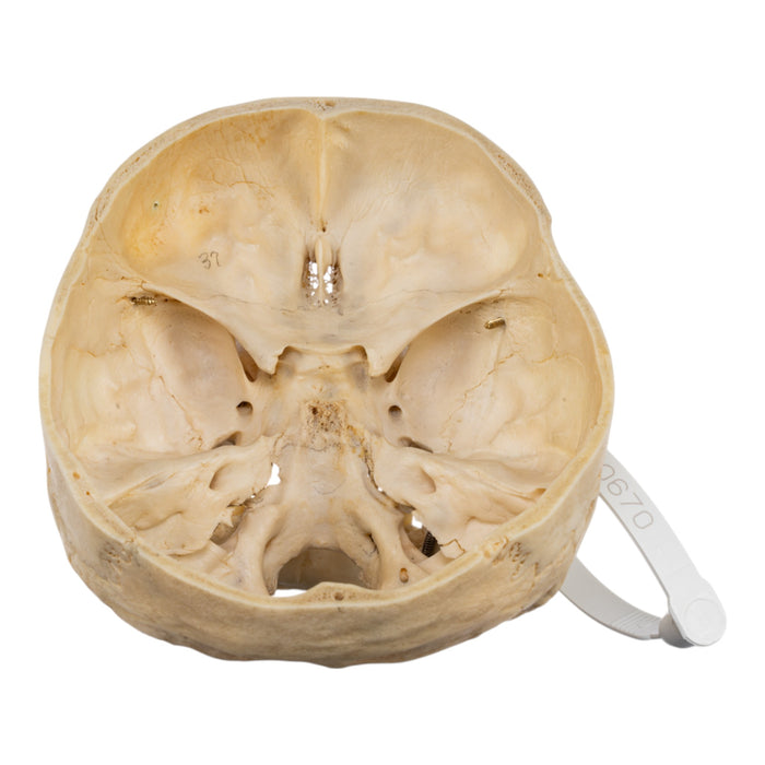 Real Human Skull - Partial