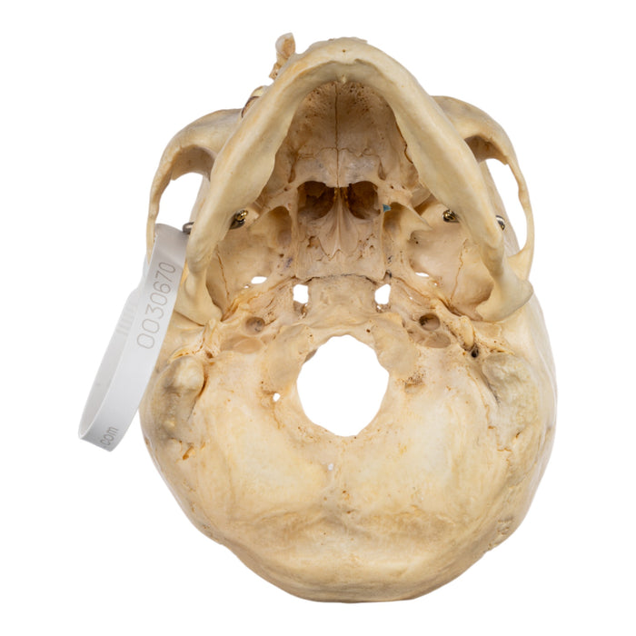 Real Human Skull - Partial