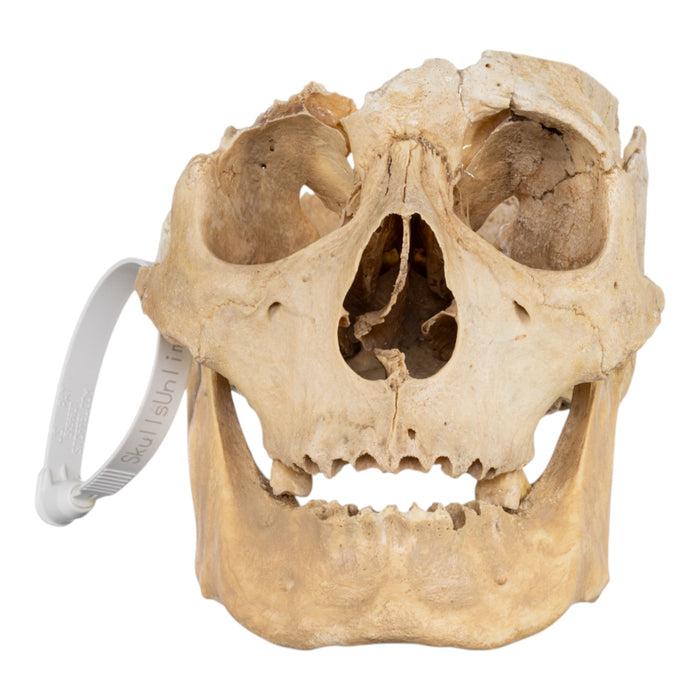 Real Human Skull - Partial