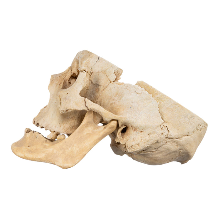 Real Human Skull - Partial