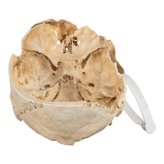 Real Human Skull - Partial
