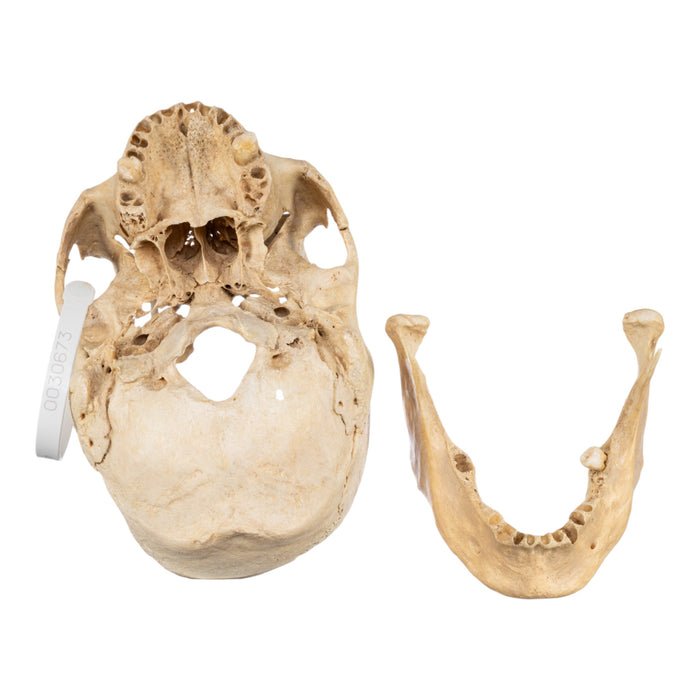 Real Human Skull - Partial