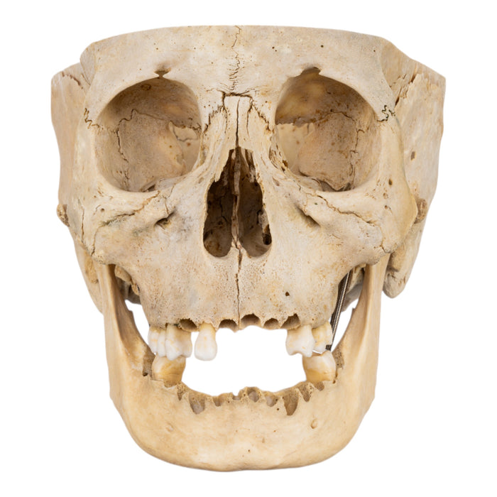 Real Human Skull - Partial