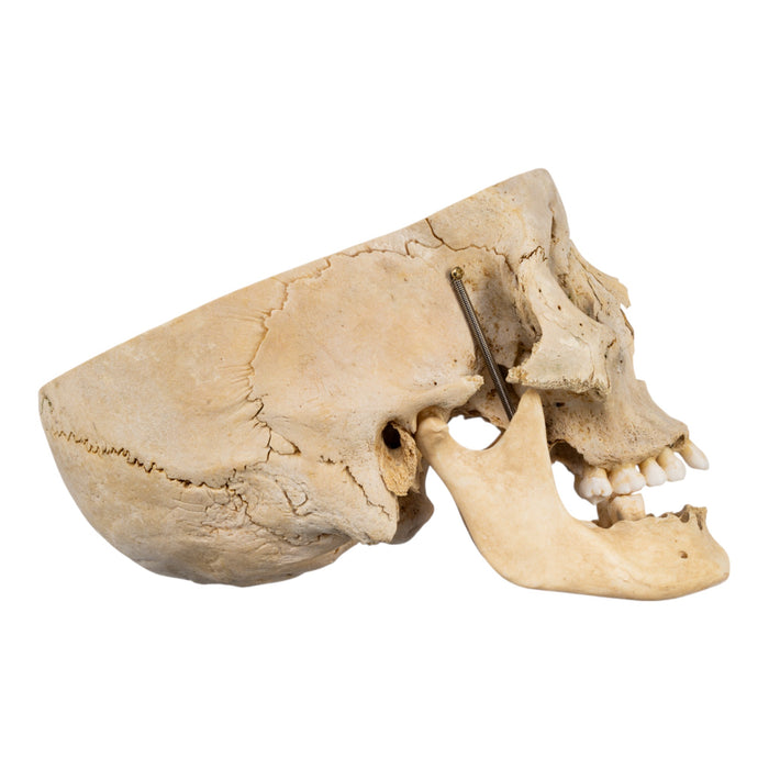 Real Human Skull - Partial