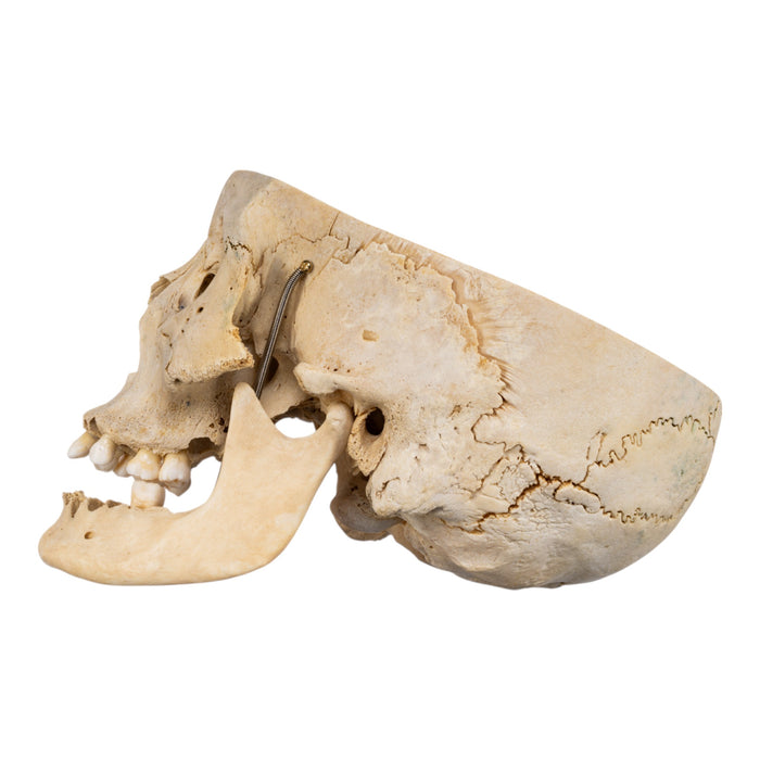 Real Human Skull - Partial