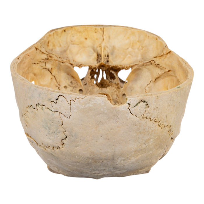 Real Human Skull - Partial