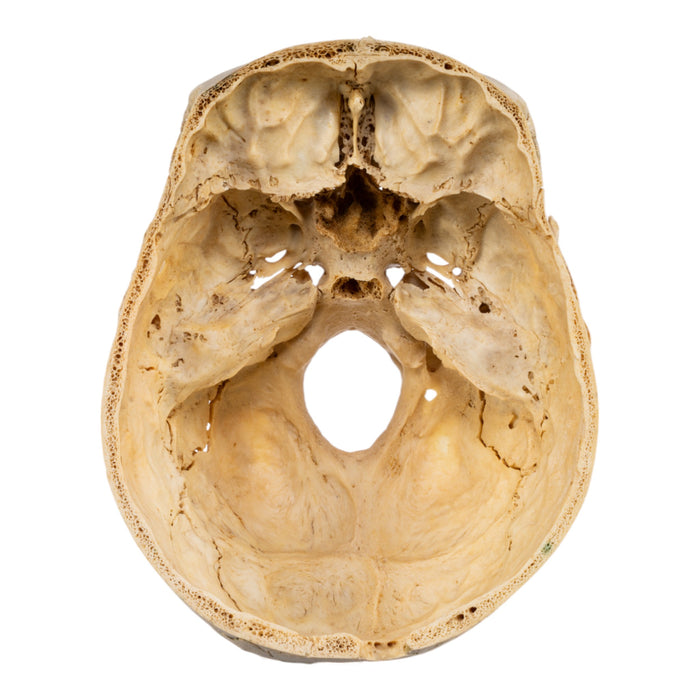 Real Human Skull - Partial