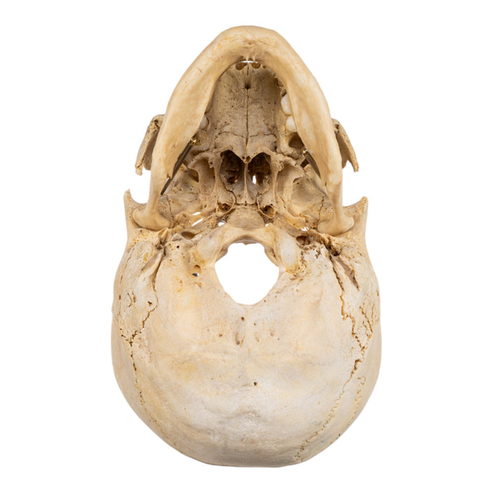 Real Human Skull - Partial