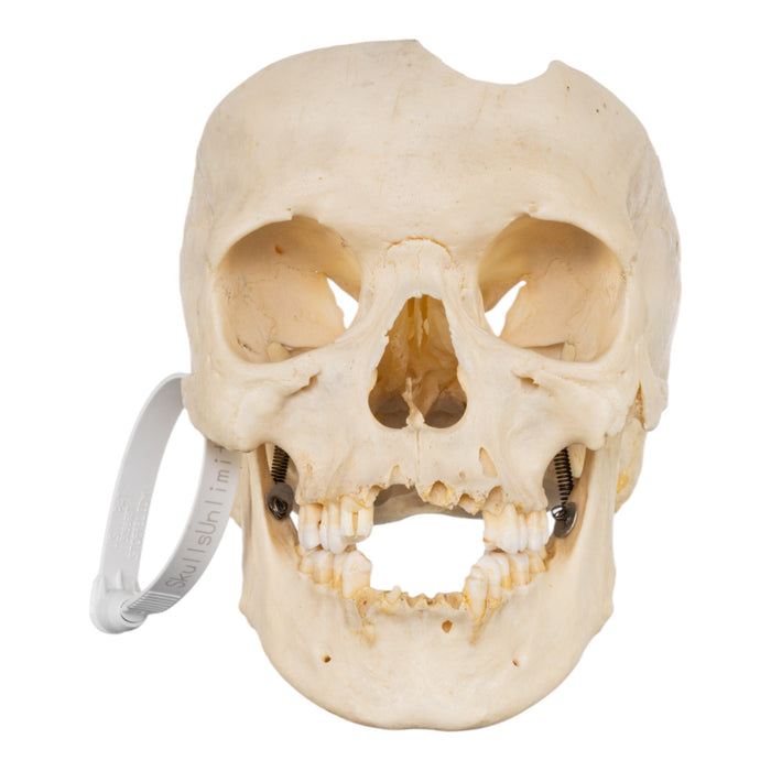 Real Human Skull - Partial