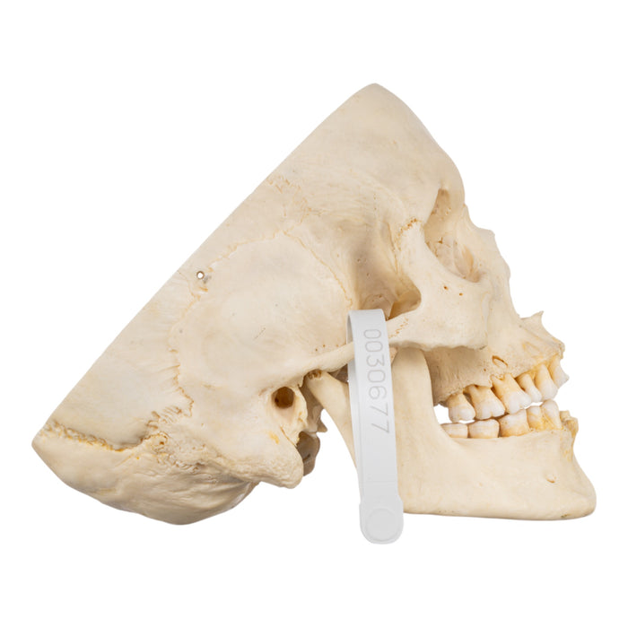 Real Human Skull - Partial