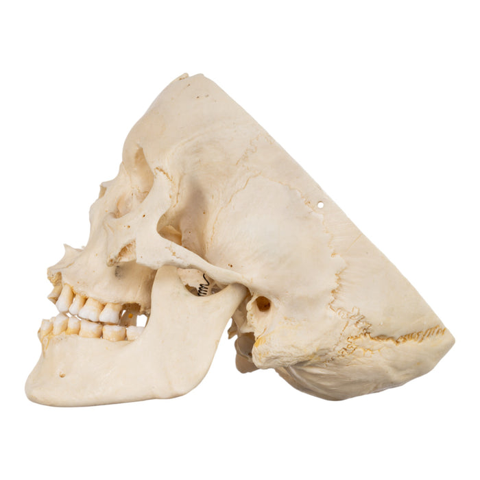 Real Human Skull - Partial