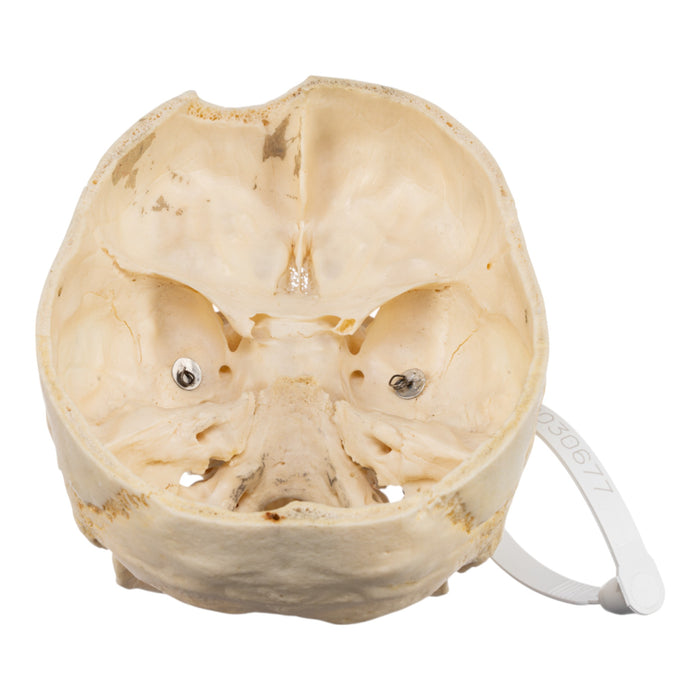 Real Human Skull - Partial