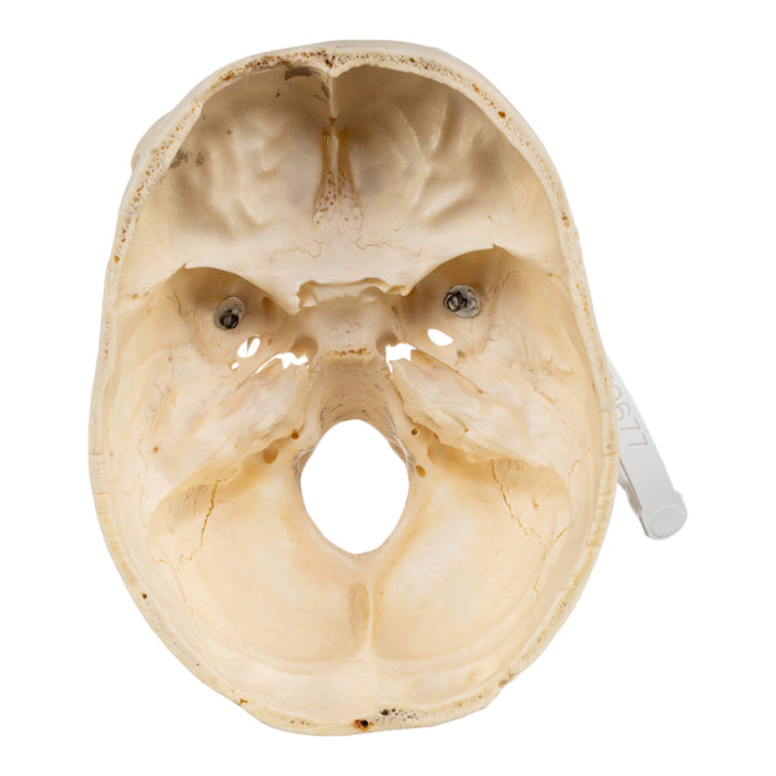Real Human Skull - Partial