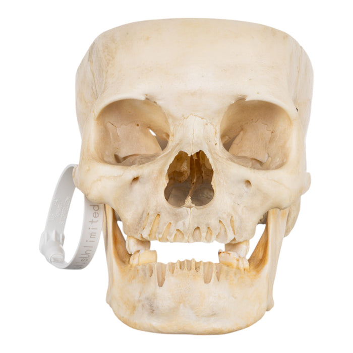 Real Human Skull - Partial