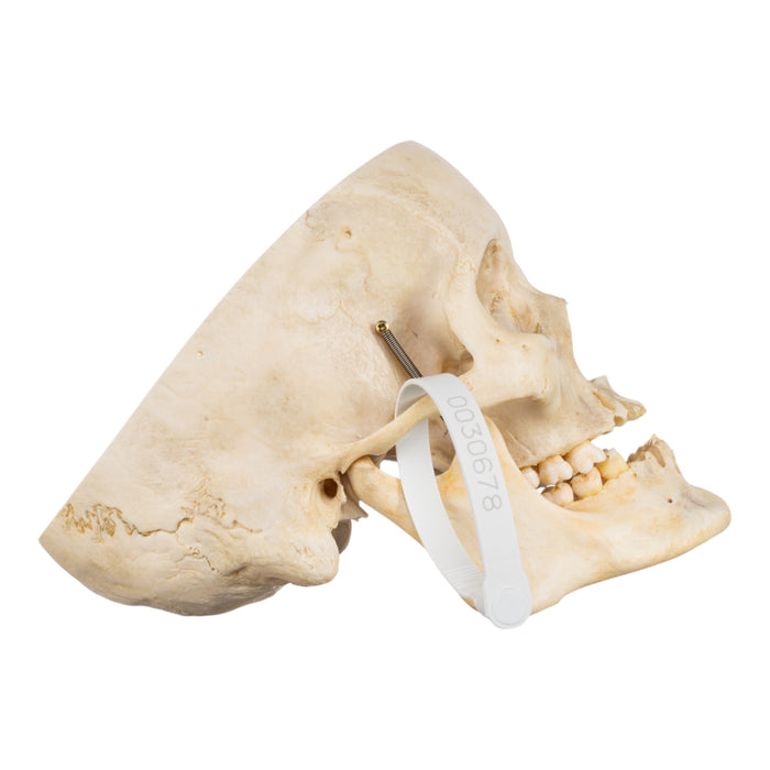 Real Human Skull - Partial