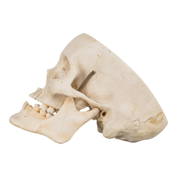 Real Human Skull - Partial