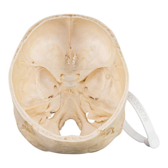 Real Human Skull - Partial