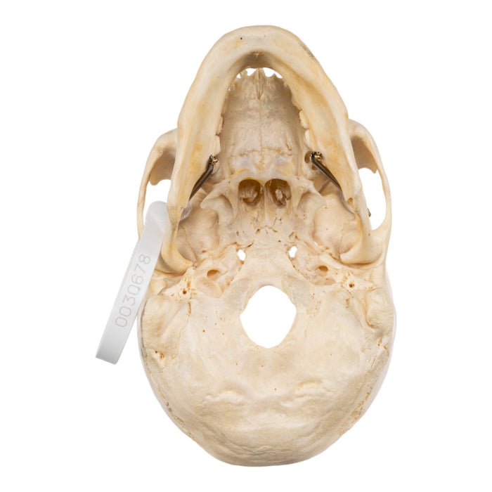 Real Human Skull - Partial