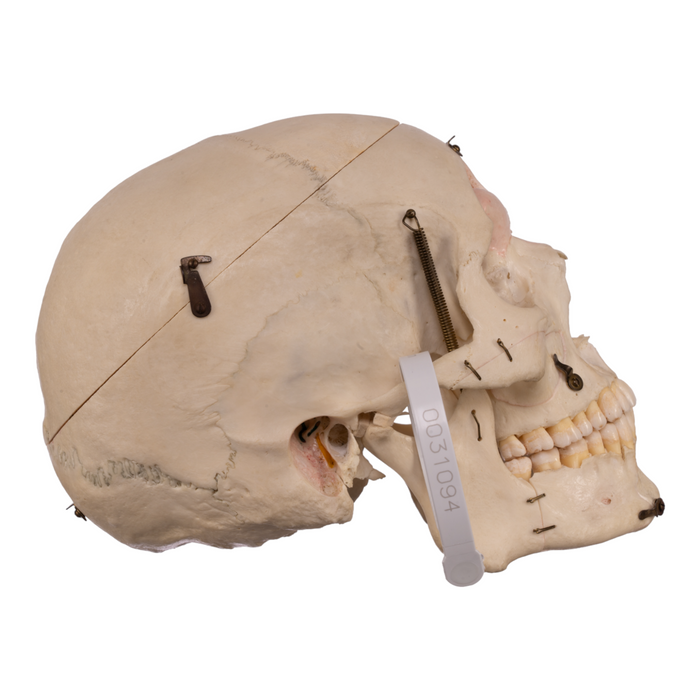 Real Dissected Human Skull with Carrying Case
