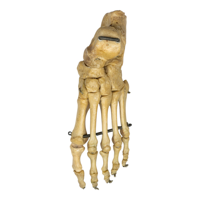 Real Human Foot - Antique