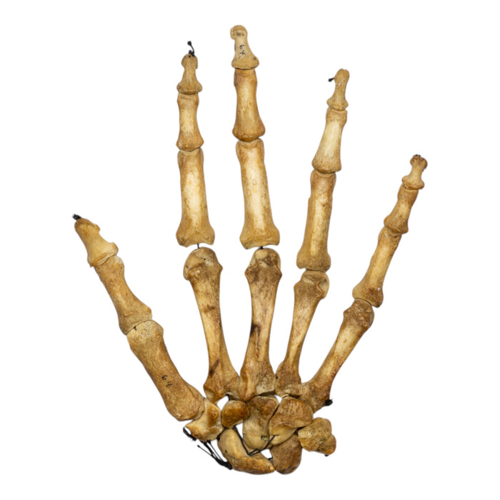 Real Human Hand - Antique