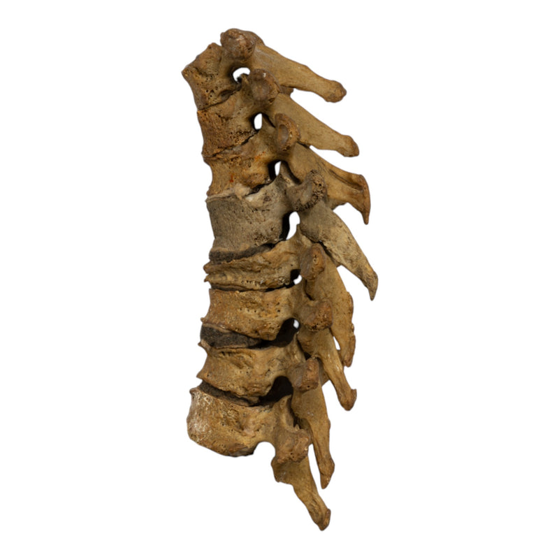 Real Human Thoracic Vertebrae - Set of 8