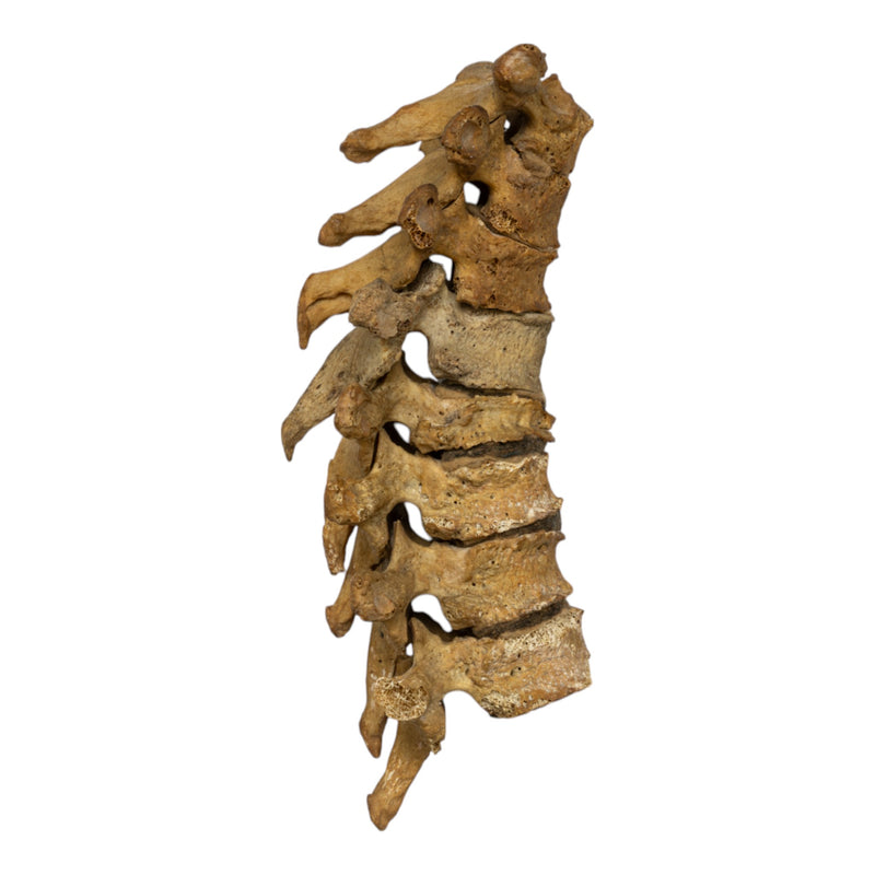Real Human Thoracic Vertebrae - Set of 8