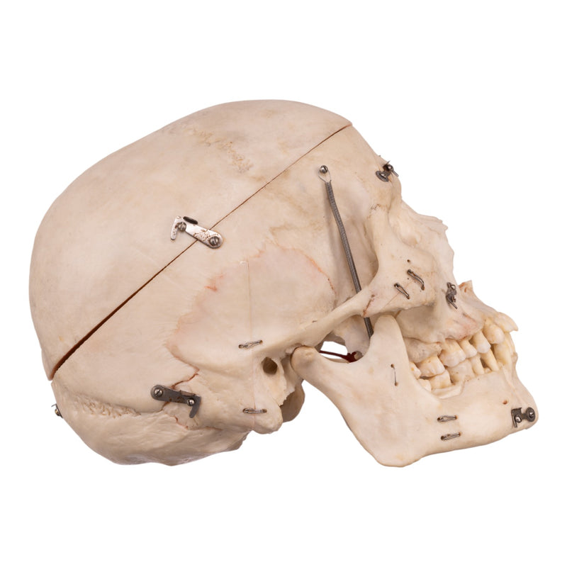 Real Human Dissected Skull with Carrying Case