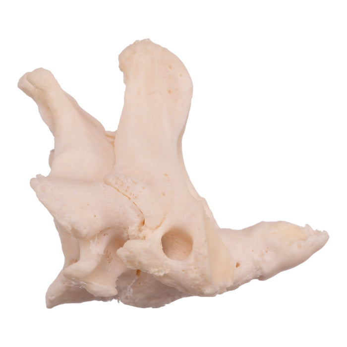 Real Research Quality Human Cervical and Axis Vertebrae - Fused