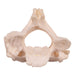 Real Research Quality Human Cervical and Axis Vertebrae - Fused
