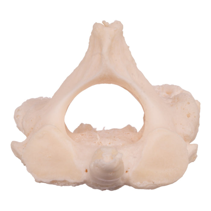 Real Research Quality Human Cervical and Axis Vertebrae - Fused