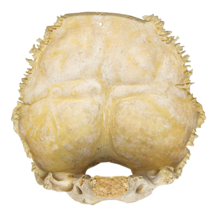 Real Human Child Occipital Bone