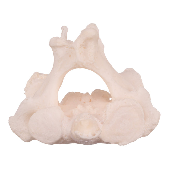 Real Research Quality Human Cervical and Axis Vertebrae - Fused