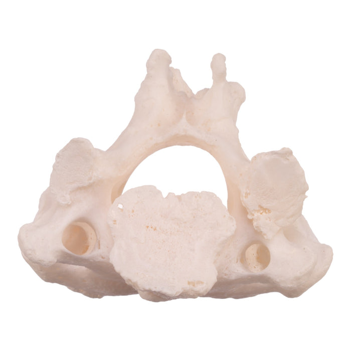 Real Research Quality Human Cervical and Axis Vertebrae - Fused