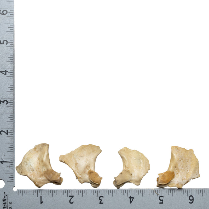 Real Human Child Exoccipital Bone - Single