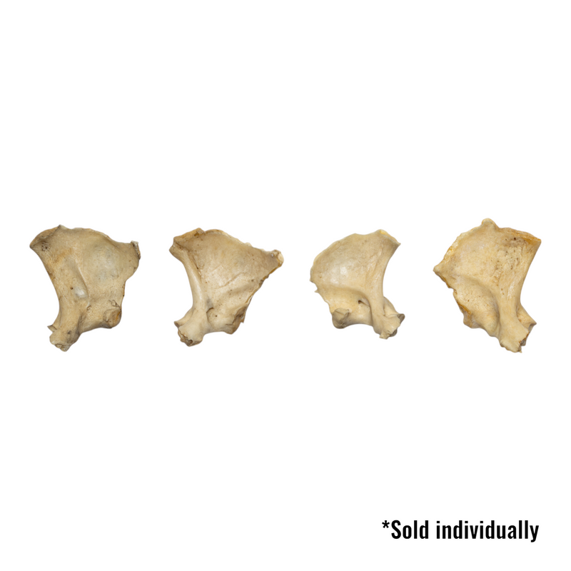 Real Human Child Exoccipital Bone - Single