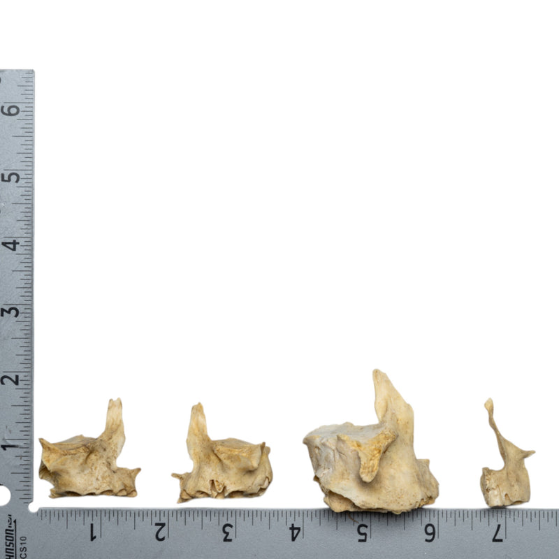Real Human Child Maxillary Bone - Single