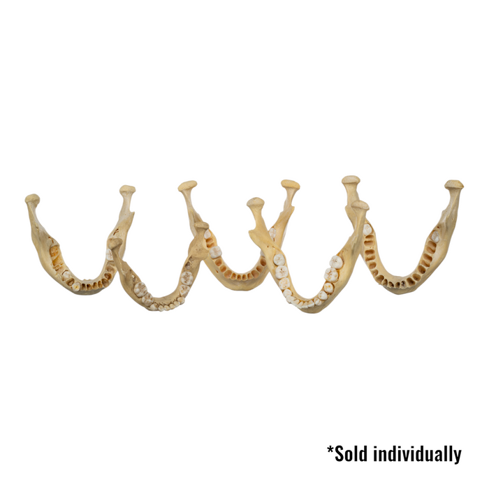 Real Human Mandible - Young
