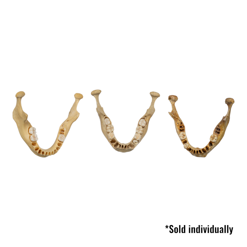 Real Human Mandible - Young (Single)