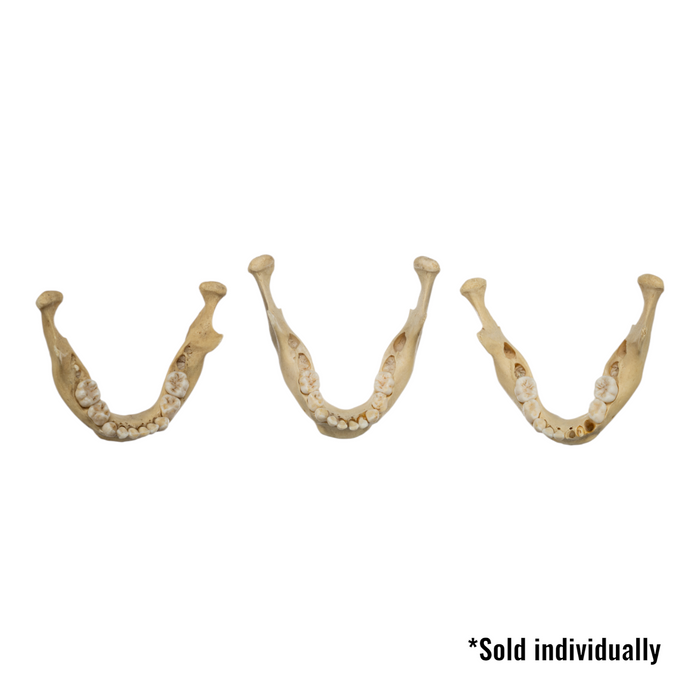 Real Human Mandible - Young