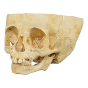 Real Human Child Skull - Partial